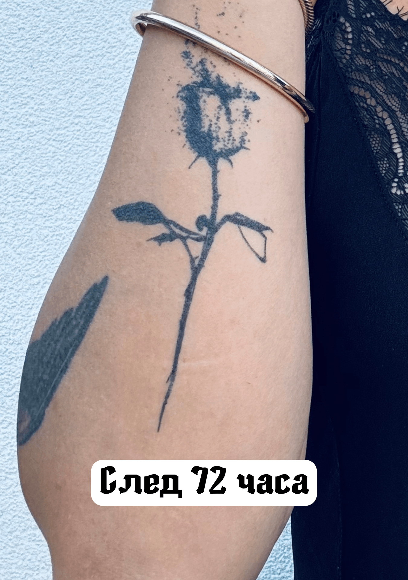 След 72 часа