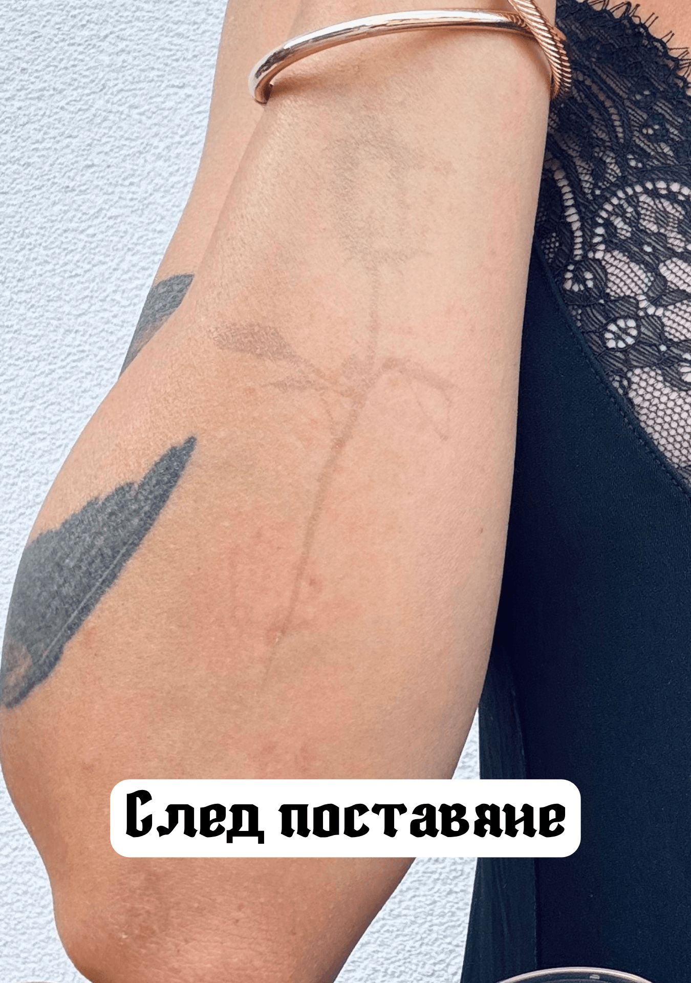 След поставяне